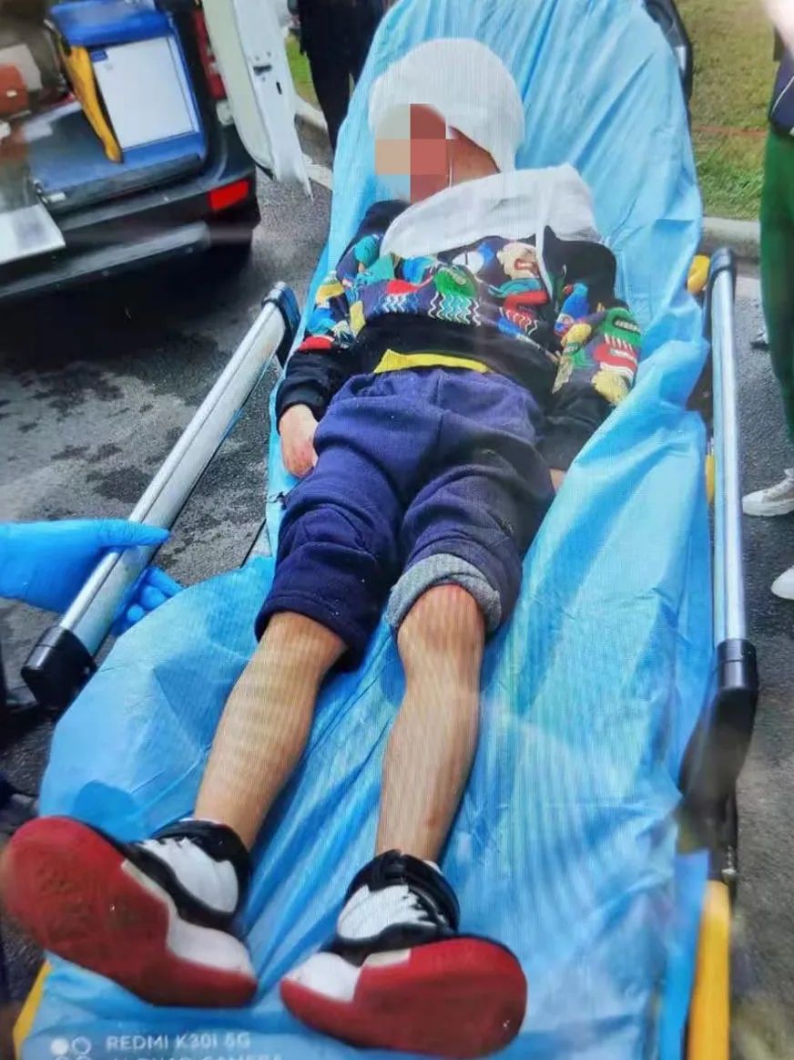 家长粗心孩子受伤 6岁男童骑滑板车突然窜进机动车道