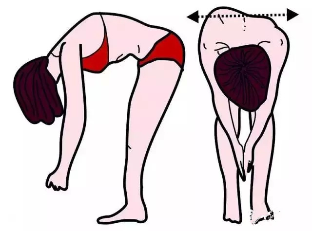 奇迹！脊柱重度侧弯180°“弯腰女孩