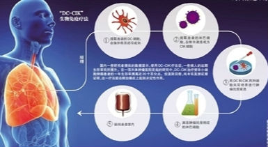 国家卫计委叫停细胞免疫疗法临床治疗