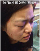 被打的中国女学生石晓琳