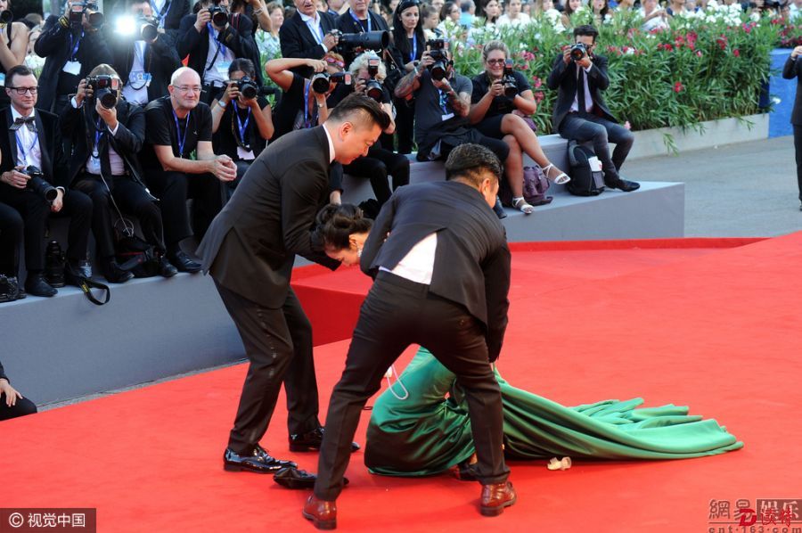 9月2日威尼斯红毯爆惊人大事件,女星梁镜珂摔倒,掉出"吸奶器",成为"奶