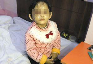 昆明2岁女童被遗留宾馆 伤痕累累疑遭虐待