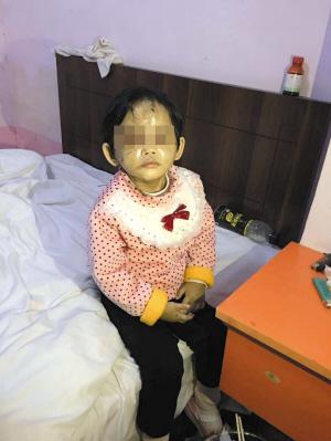 2岁女童被遗留宾馆 伤痕累累疑遭虐待
