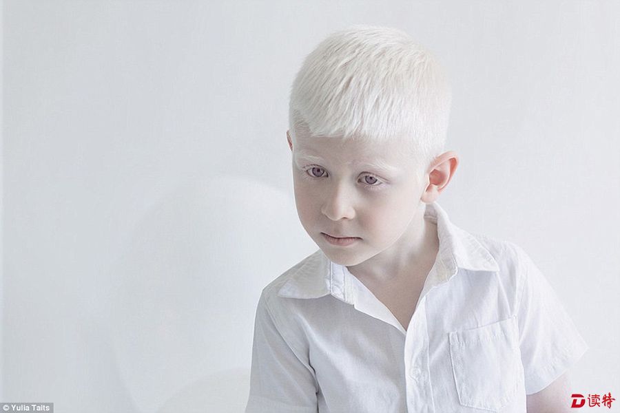 五十度白:梦幻纯白摄影 展现白化病之美