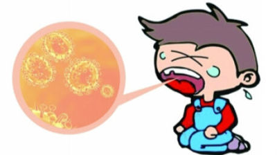 亲吻孩子真的会传染疱疹性咽峡炎吗？