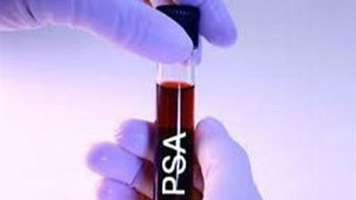 5、前列腺癌检查时，不要轻易做“PSA检查”