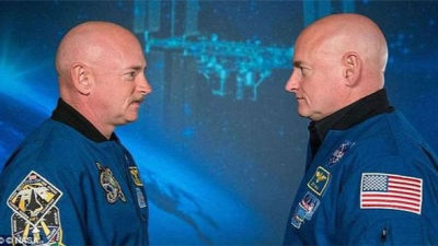 双胞胎分别在地球和太空：一年后变化惊人