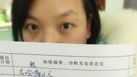 女白领春节每晚追剧到凌晨3点 眼中长满结石