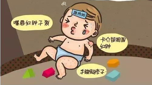 婴儿患上川崎病，元凶或是“亲亲抱抱” 