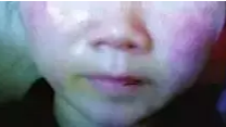 女子怀孕40天面临流产，竟是面膜惹的祸