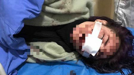 丽江古城法院受理“丽江女子被打毁容”案件