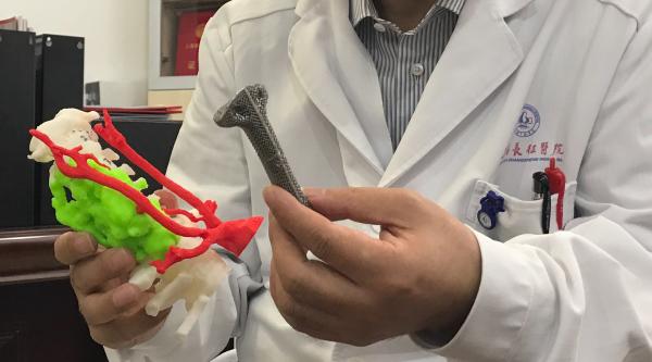 世界首例！上海一医院用3D打印将全颈椎椎体换为钛合金