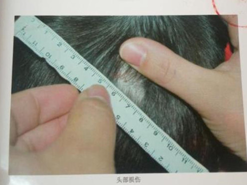 吉林四平红黄蓝幼儿园虐童案宣判 涉事教师被刑拘