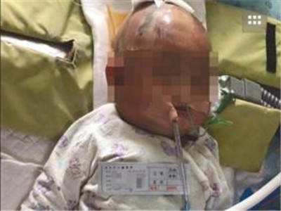 女婴被高楼坠落苹果砸中 警方提全楼DNA查出抛物者