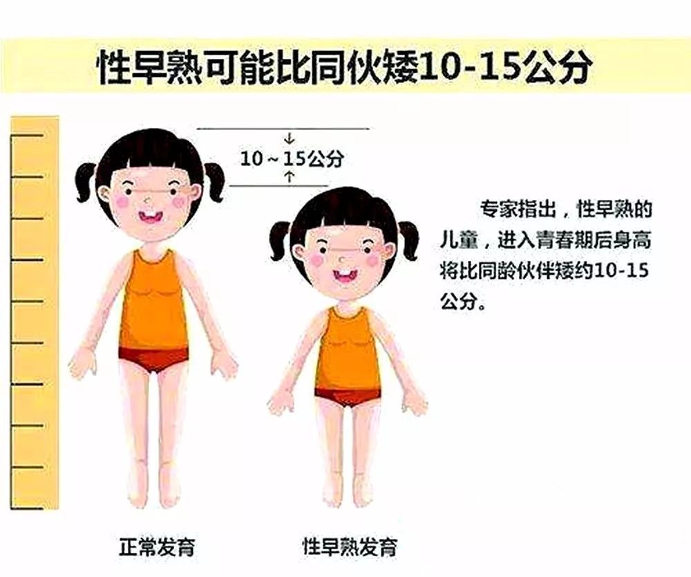 4岁女童被诊断出性早熟医生提醒家长这样做