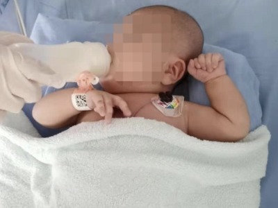 出生率仅1% 的“镜面人”，深圳这个弃婴离死亡曾只有五分钟……