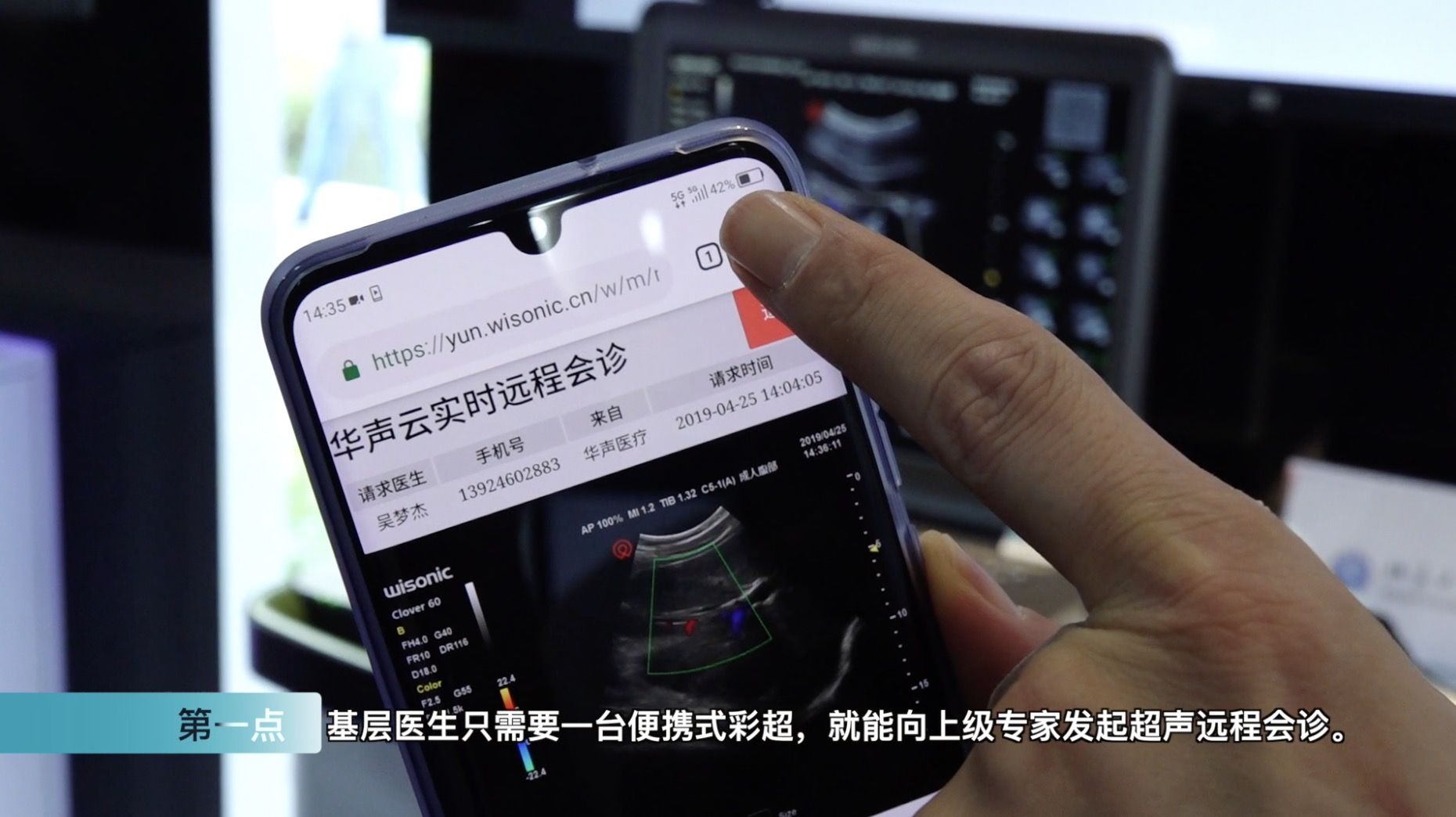 惊爆！5G网络让国际名医给你远程会诊！