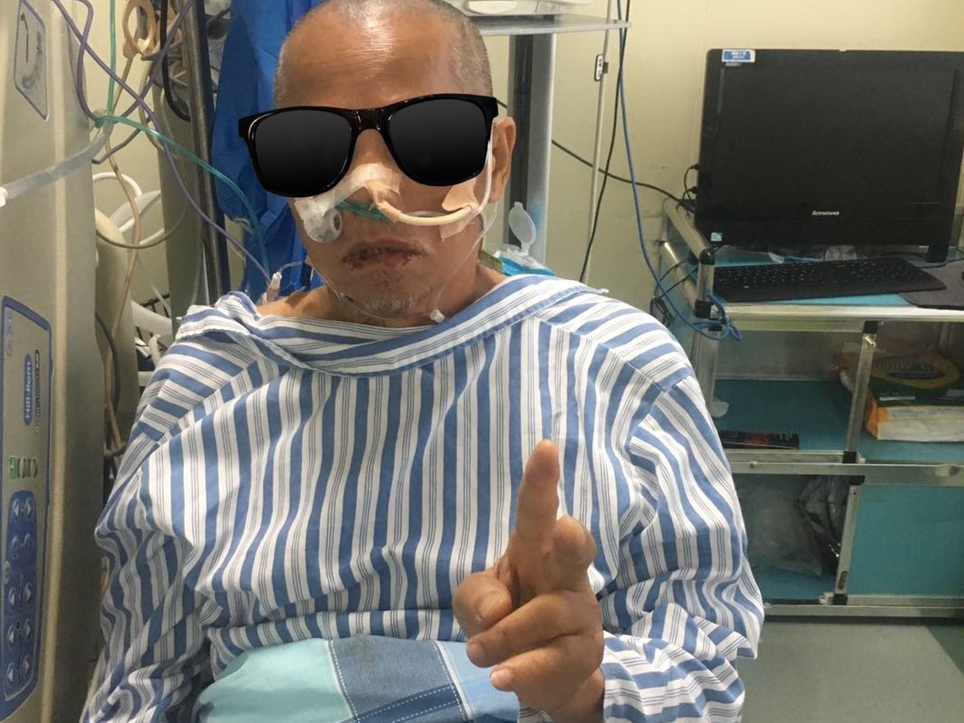 兽医下10克雄黄“猛药”给自己治病，多器官衰竭差点没命！
