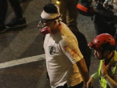 香港暴徒又内讧：“非暴力”集会上，一男子被“自己人”爆头