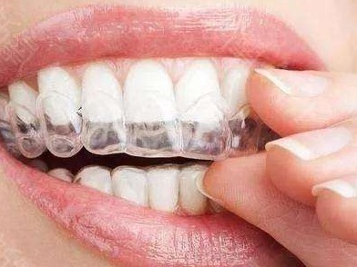 价格“酸爽”也得矫正 必须戴牙套的你选对医生了吗？