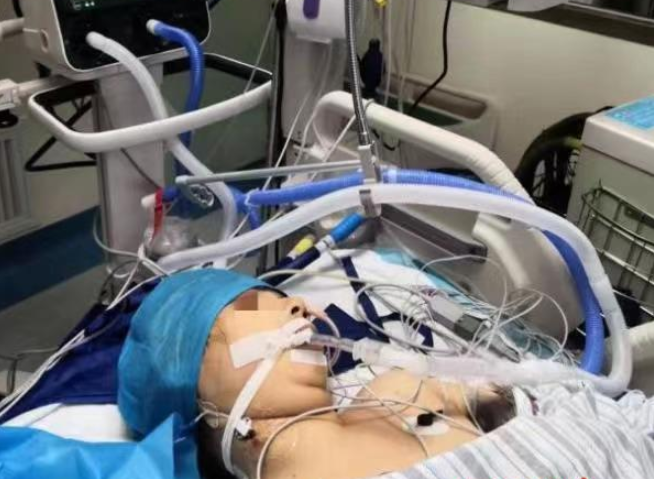 昏迷7天！一串疱疹竟把她送进了ICU，一定要警惕那种沾上就甩不掉的病毒！