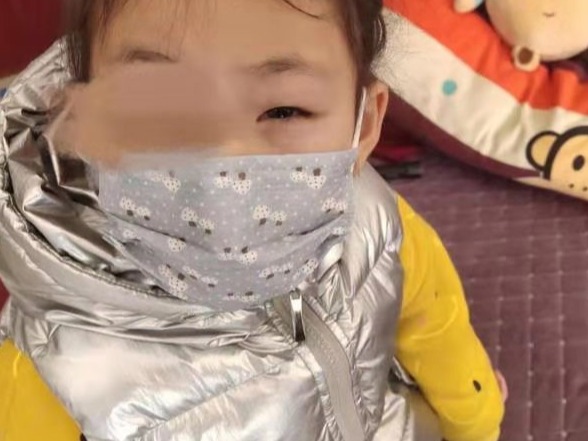 眼内被塞纸片女童再诊断未见异常，校方签赔偿协议担一成责任