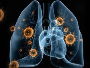 山西省确认首例新型肺炎确诊病例