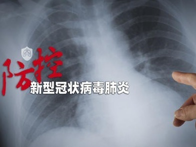 广东省推出防控新冠病毒感染的肺炎疫情一级响应16条措施