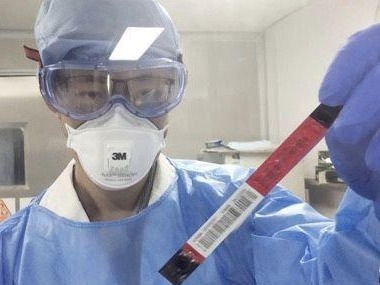 （重稿）全球首家单人份化学发光新型冠状病毒抗体检测试剂盒宣布获得成功