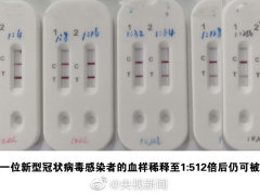 钟南山指导研发快速检测试剂盒：15分钟内可取结果
