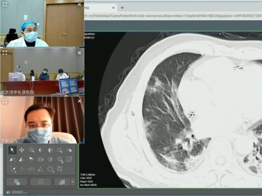 5G远程CT：“北上广”医疗专家在线抗击疫情