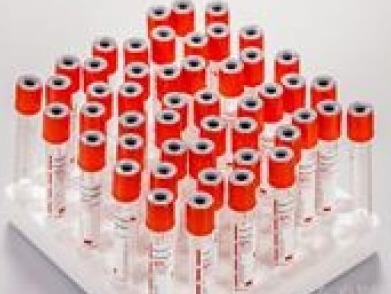 美国疾控中心宣布研发出新型新冠病毒试剂盒  