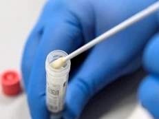 专家解释新冠病毒导致味觉嗅觉失灵的原因  
