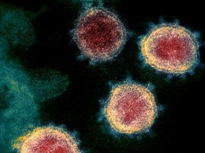 美国最新研究称纽约疫情病毒源头来自欧洲