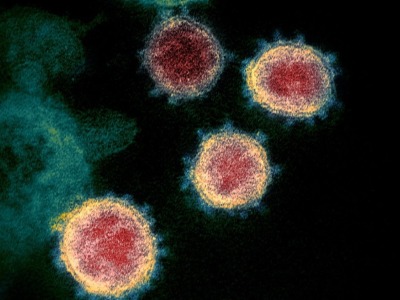 新冠病毒为何会导致年轻人血栓和中风增加？