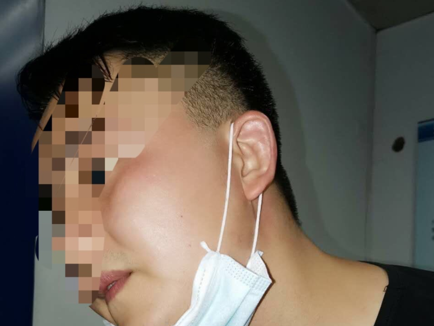 女子公园醉酒打伤两保安