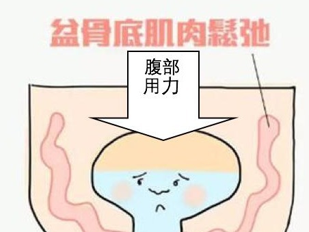 很多产妇会得的这类病，这家医院可提供上门康复服务了！