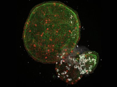 《自然》研究：微型器官揭示新冠病毒如何攻击人体