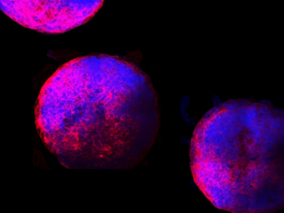 科学家首次在实验室里用干细胞培育出功能性微型人类心脏模型 