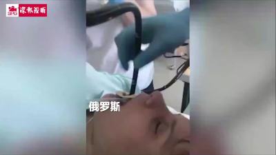 俄罗斯医生从女子嘴里取出一米长蛇 患者称为午睡时意外爬进