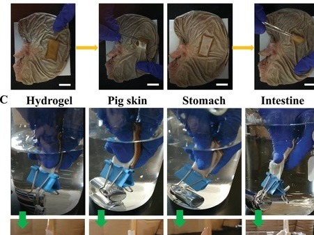 中国团队设计“两面神”黏附水凝胶：一贴修复内脏器官