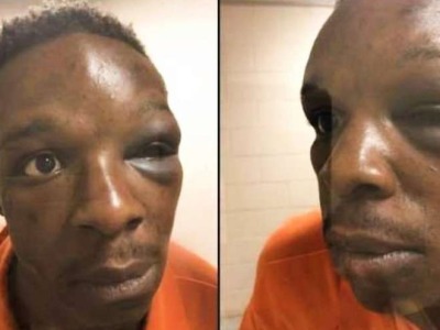 美国警方再现暴力执法，非裔男子被打到昏迷
