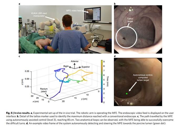 英科学家发明结肠镜检查机器人，可在实时视觉分析下自主运动