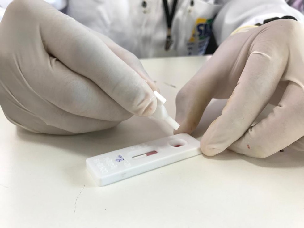 巴西里约州7万只新冠病毒检测盒有质量问题