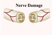 修复受损神经，可拉伸的导电水凝胶或可助一臂之力