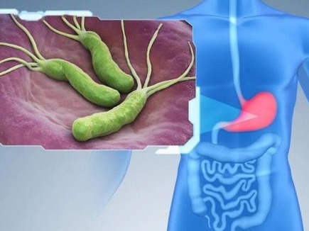 喝蜂蜜、吃大蒜……治疗幽门螺旋杆菌感染，这些方法真有用吗？