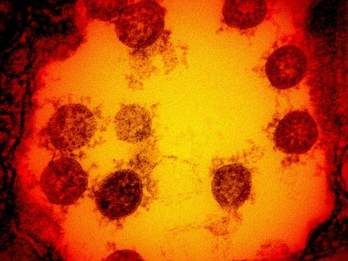 日本境内首次发现来自南非的变异新冠病毒