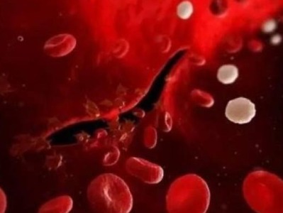 最新血液分析技术：不再破坏DNA证据，能区分动物与人血液