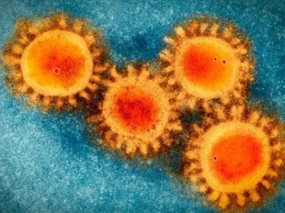 巴西发现新冠病毒新变种，尚未确定与英国发现的是否为同一变种 