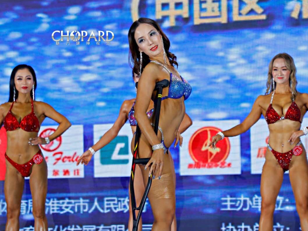 独腿姑娘健美比赛夺冠：曾是跳高运动员，担任北京奥运火炬手